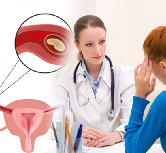 Dış Gebelik Tedavisi