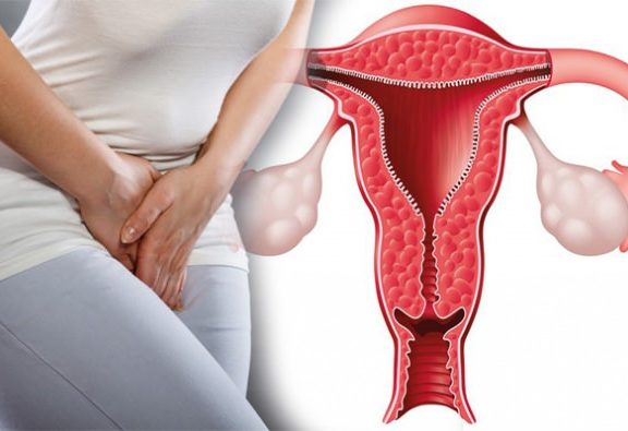 Rahim Duvarı Kalınlaşması